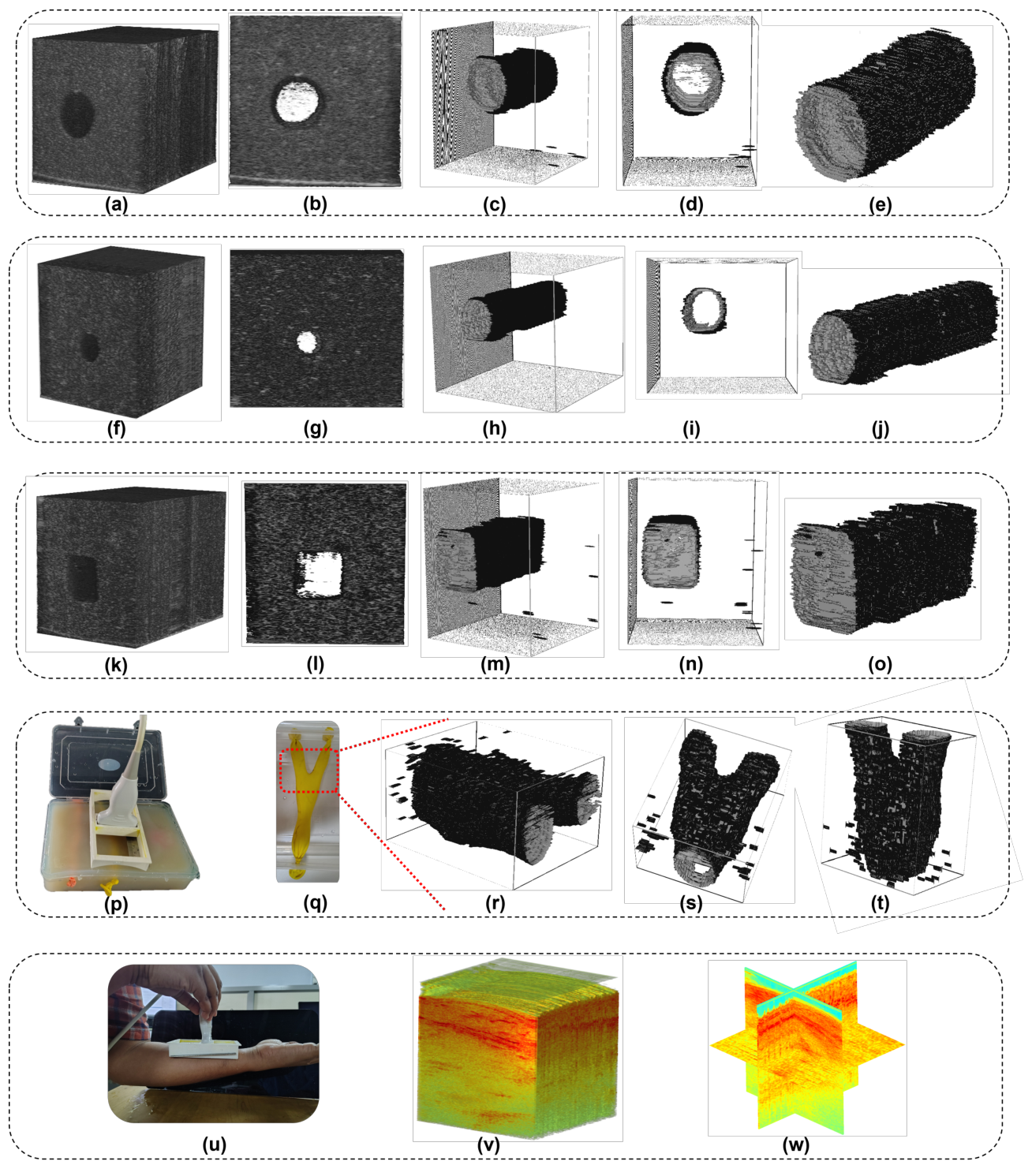 Reconstructed volumes acquired through the reflector integrated mask. Rows show a 10 mm cylindrical pipe, a 5 mm cylindrical pipe and a 10 mm square section pipe, each as a B-mode isometric view, a B-mode front view and three extracted views of the segmented shape. A fourth row shows the bifurcated tube phantom in its holder, its photograph, and three extracted views of the reconstructed bifurcation. A final row shows a forearm being scanned through the mask, the reconstructed volume and its orthogonal slices.
