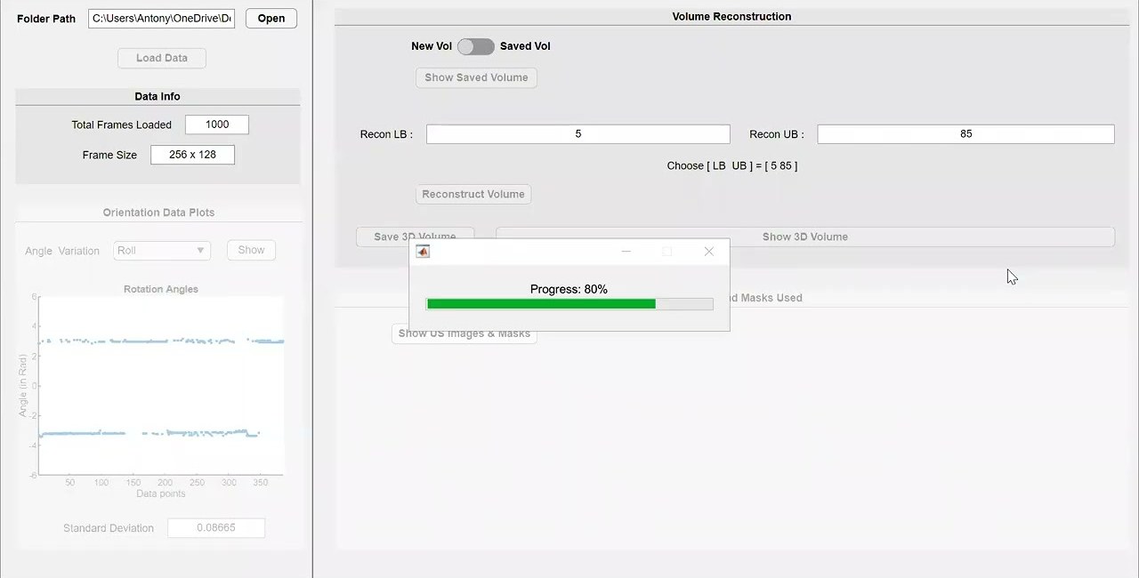 Screen recording of the reconstruction application showing a data panel with 1000 frames loaded at 256 by 128, a rotation angle plot, and a volume reconstruction panel with a progress bar at 80 percent.