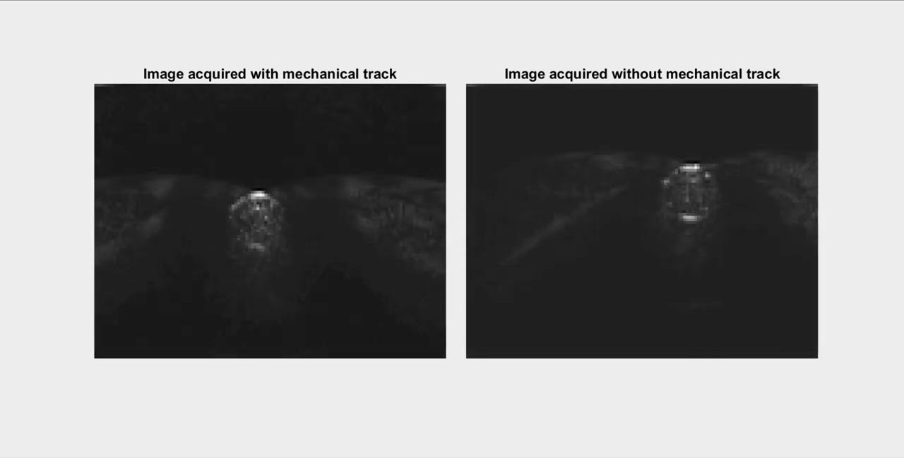 Two B-mode images of a tube phantom side by side, one labelled image acquired with mechanical track and the other image acquired without mechanical track.