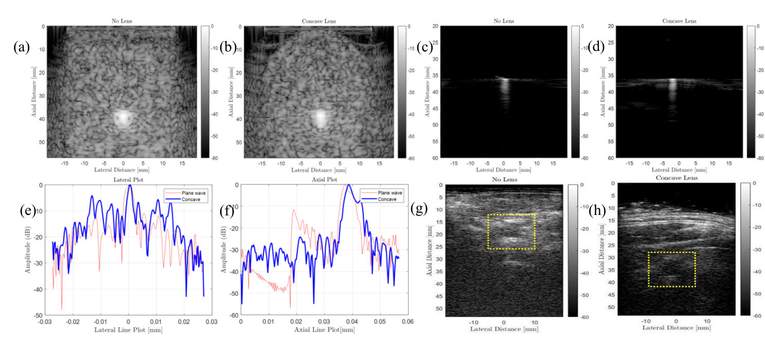Eight panel montage: simulated pin phantom B-mode images with and without the concave lens, water pin phantom images with and without the lens, lateral and axial line plots through the pin, and cross sectional carotid images with and without the lens.