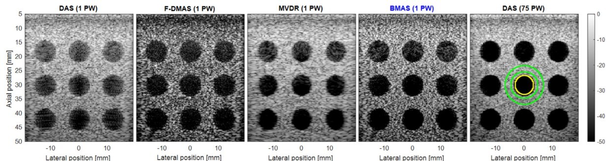 B-mode images reconstructed with DAS, F-DMAS, MVDR, BMAS and 75-angle compounded DAS for the contrast evaluation dataset.
