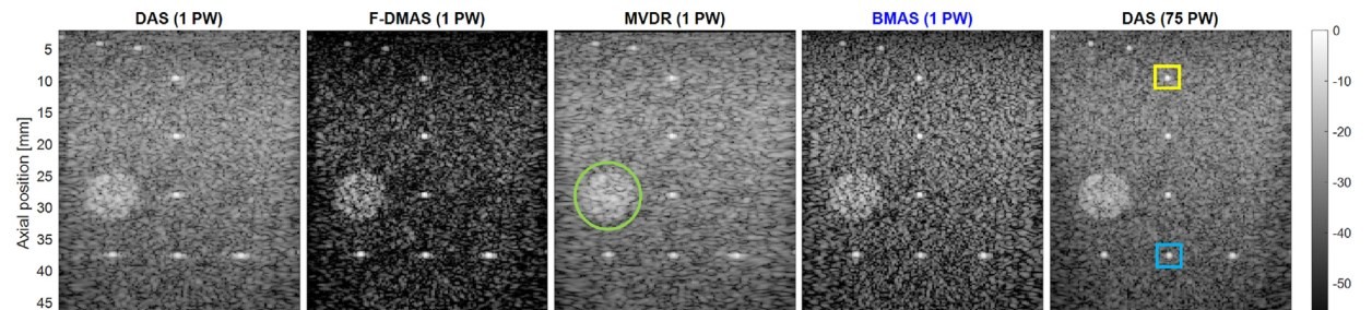B-mode images reconstructed with DAS, F-DMAS, MVDR, BMAS and 75-angle compounded DAS for the resolution-distortion dataset.