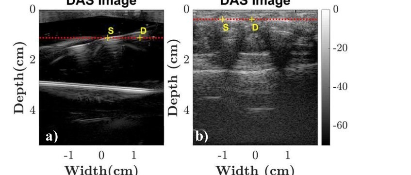Coherently compounded DAS images of a gelatin wire phantom and an in-vivo back palm with the line of interest and specular and diffuse pixels marked.