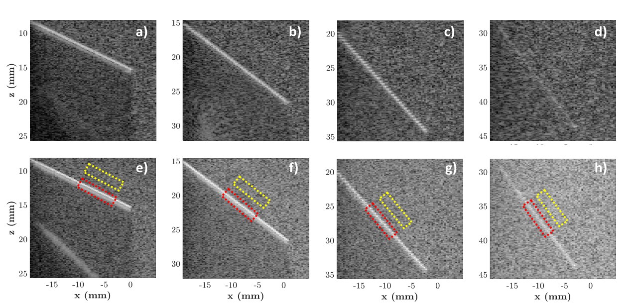 B-mode images of k-Wave simulated needle insertions across transmission schemes and inclinations.