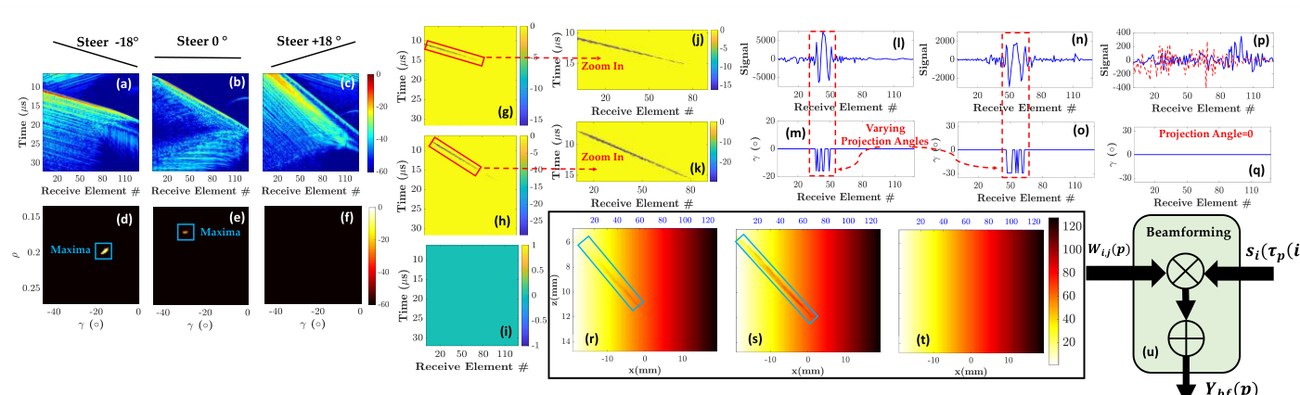 The complete reflection tuned apodization pipeline from RF data through Radon transforms and projection maps to apodization windows and beamforming.