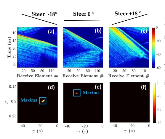 RF data for plane wave transmissions at minus 18, 0 and plus 18 degrees with their Radon transforms and maxima.