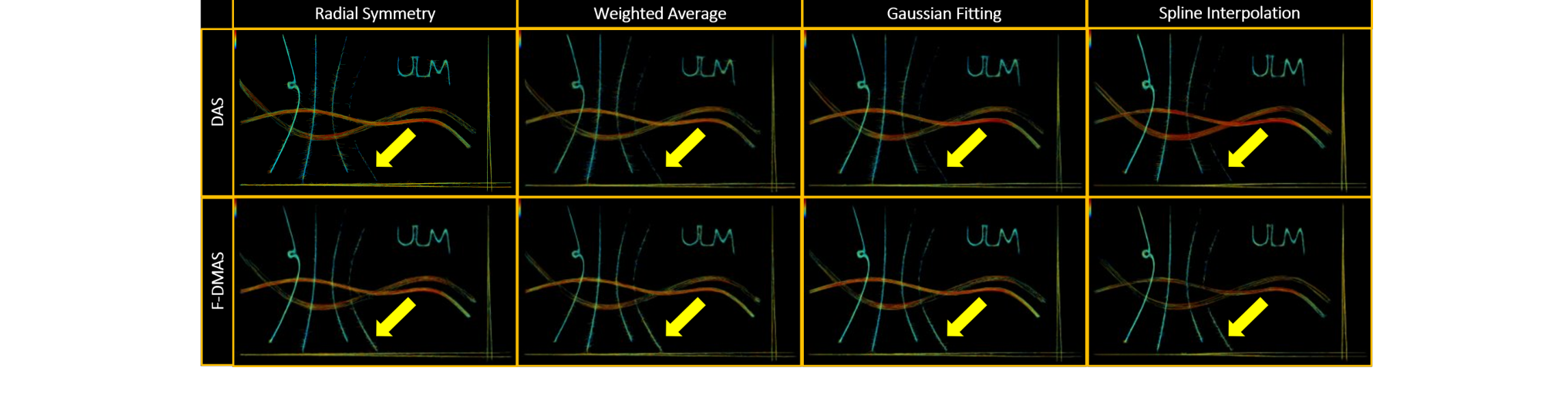 Velocity maps comparing DAS and F-DMAS with flow direction arrows