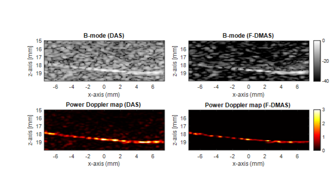 In-vitro B-mode and Power Doppler maps comparing DAS and F-DMAS