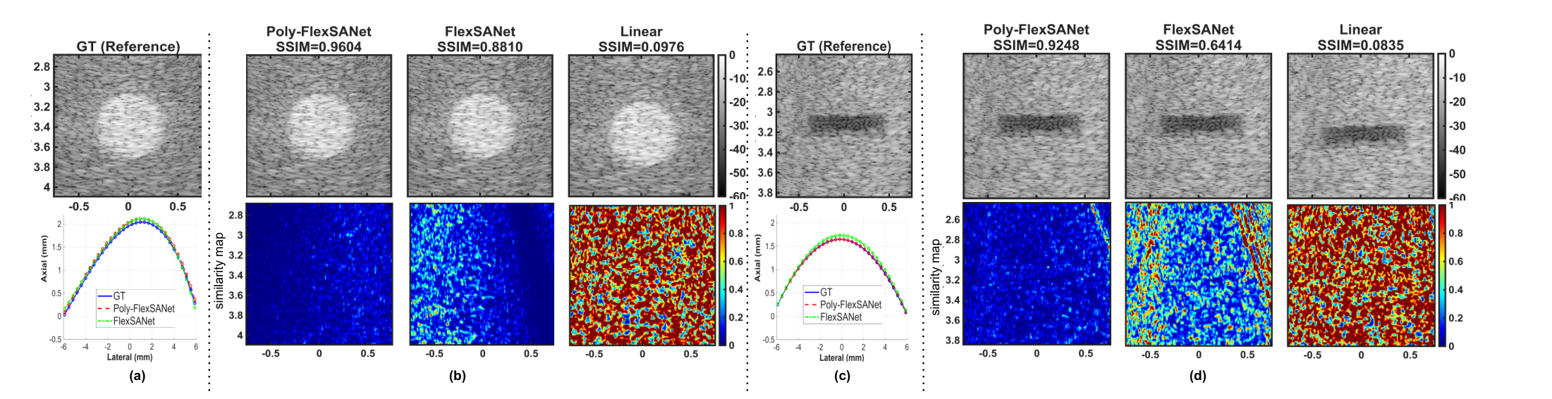 Cyst and vessel evaluation cases. For each, ground-truth B-mode with predicted geometry alongside Poly-FlexSANet, FlexSANet and Linear reconstructions with their SSIM scores and similarity maps.