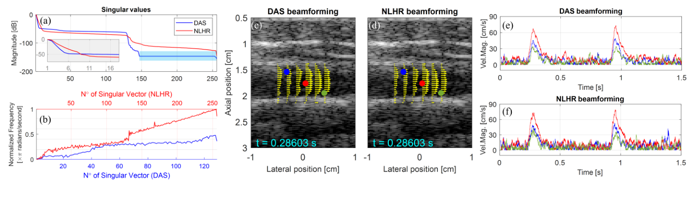 In-vivo carotid results comparing DAS and NLHR beamforming with velocity magnitude traces