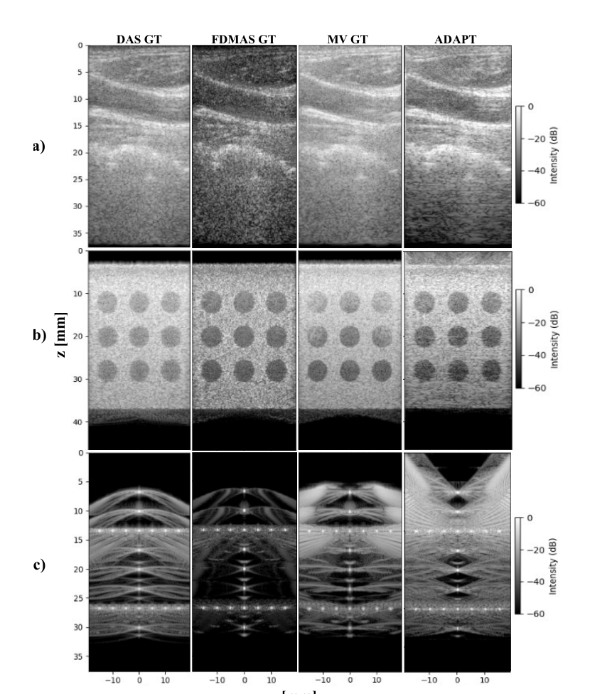 B-mode comparison of DAS, FDMAS and MV ground truths against ADAPT on in-vivo carotid, in-silico cyst and in-silico pin target PICMUS datasets.