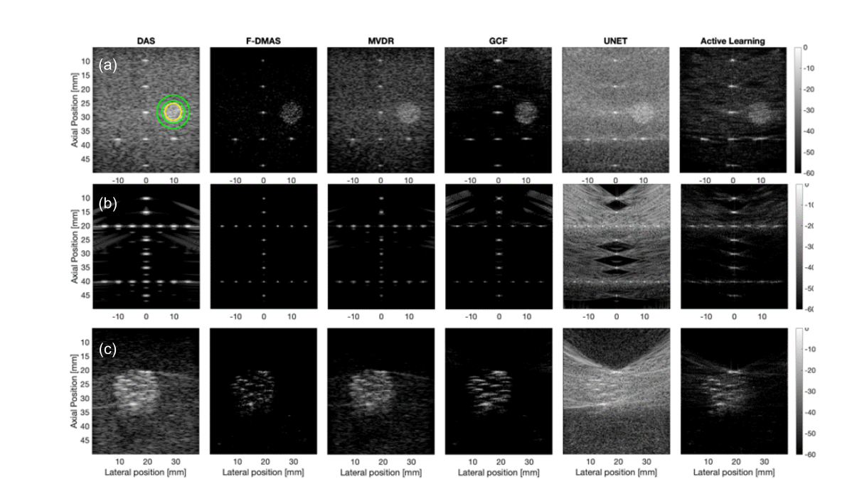 B-mode images of CIRS phantom, PICMUS point targets and in-vitro inclusion targets beamformed by DAS, F-DMAS, MVDR, GCF, a conventional U-Net and the active learning model.