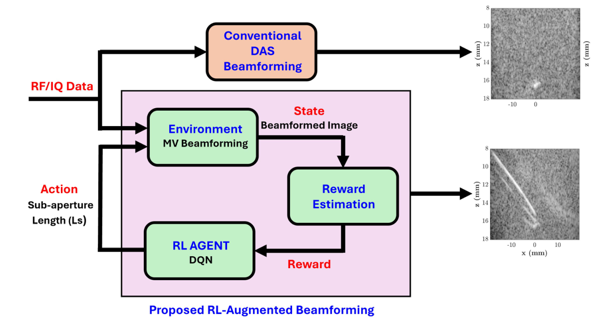 Block diagram of the reinforcement learning augmented beamforming loop: minimum variance beamforming as the environment, beamformed images as states, a Deep Q-Network agent choosing the sub-aperture length from a reward.