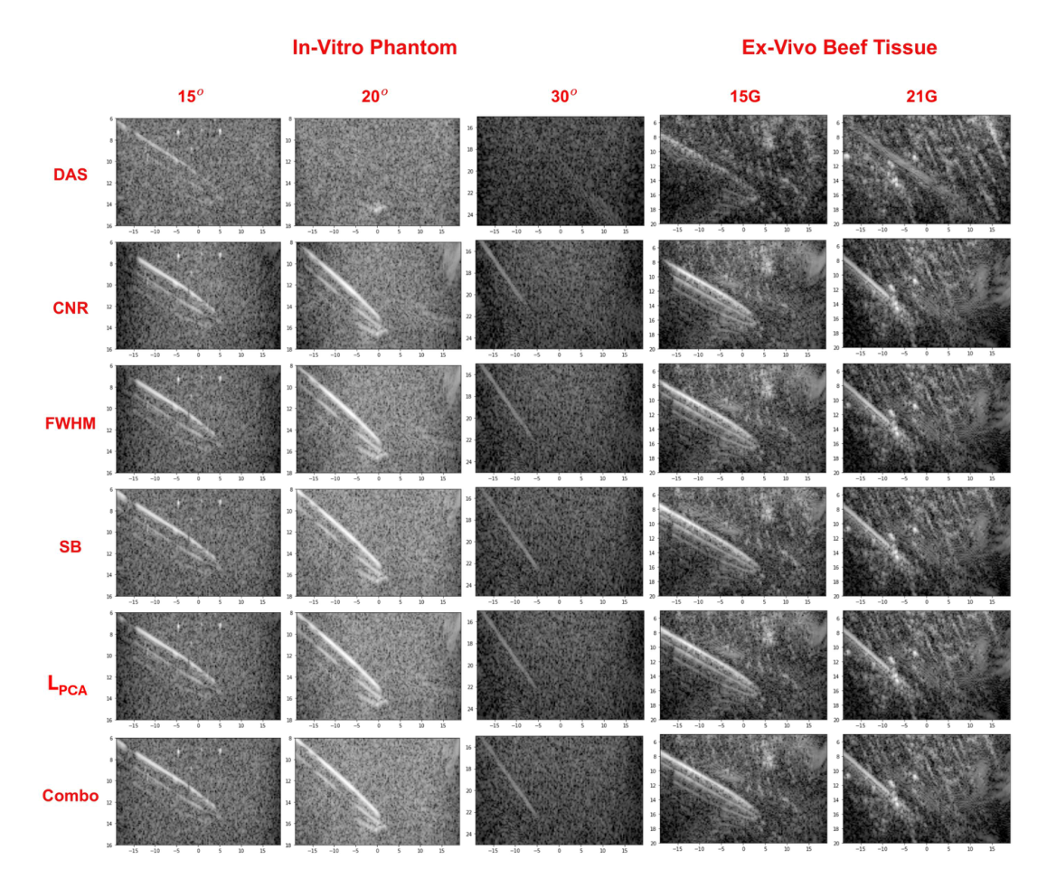 B-mode images of in-vitro phantom needle insertions at 15, 20 and 30 degrees and ex-vivo beef tissue insertions with 15G and 21G needles for DAS and five reward variants.