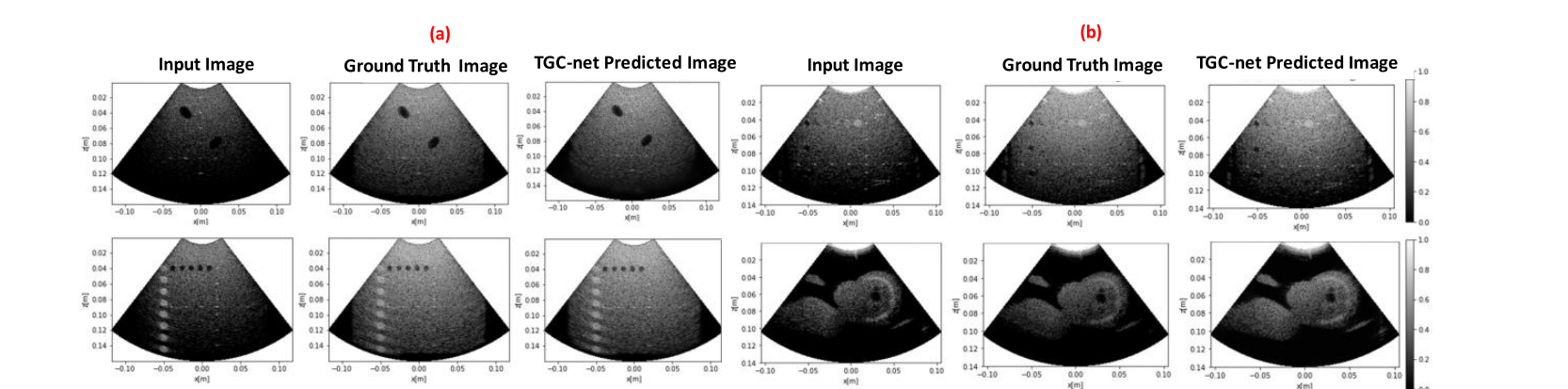Simulated and experimental curvilinear ultrasound images before gain correction, with algorithmic ground truth correction, and as predicted by TGC-net.