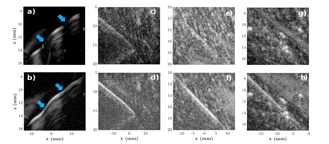 B-mode images of a curved copper wire in gelatin and of 15G, 18G and 21G needles in beef tissue, comparing plane wave and synthetic transmit aperture transmissions.