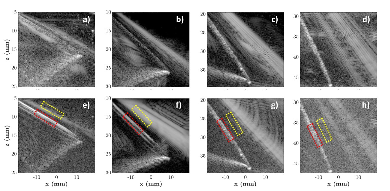 B-mode images of a 15G needle in a water bath for plane wave and synthetic transmit aperture transmissions at four insertion angles.