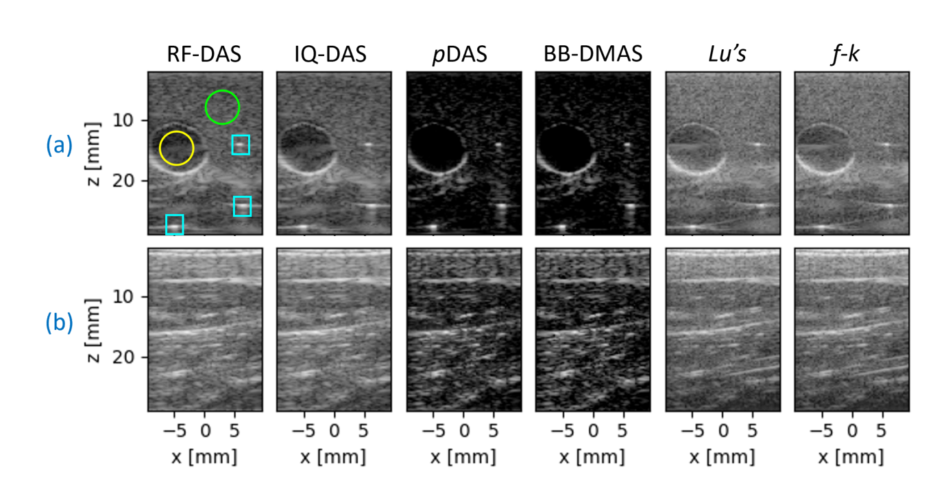 A grid of reconstructed B-mode images. The top row shows an in vitro phantom containing an anechoic cyst and point targets, the bottom row a preliminary in vivo scan, each reconstructed by six beamformers: RF-DAS, IQ-DAS, pDAS, BB-DMAS, Lu's method and f-k migration, with lateral axis in millimetres and depth axis in millimetres.