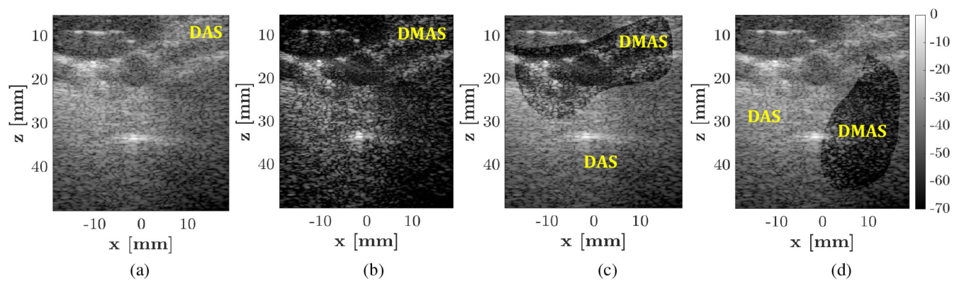 Four B-mode images of an in vivo carotid artery longitudinal axis dataset. The first is beamformed entirely with delay and sum, the second entirely with delay multiply and sum, and the third and fourth show single frames in which separate regions are labelled DAS and DMAS, demonstrating pixel level selection between the two schemes.