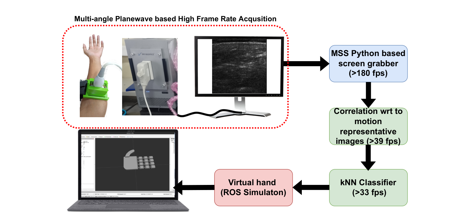 Block diagram of the proposed pipeline from multi-angle plane wave acquisition through screen grabbing, correlation and kNN classification to the ROS virtual hand.