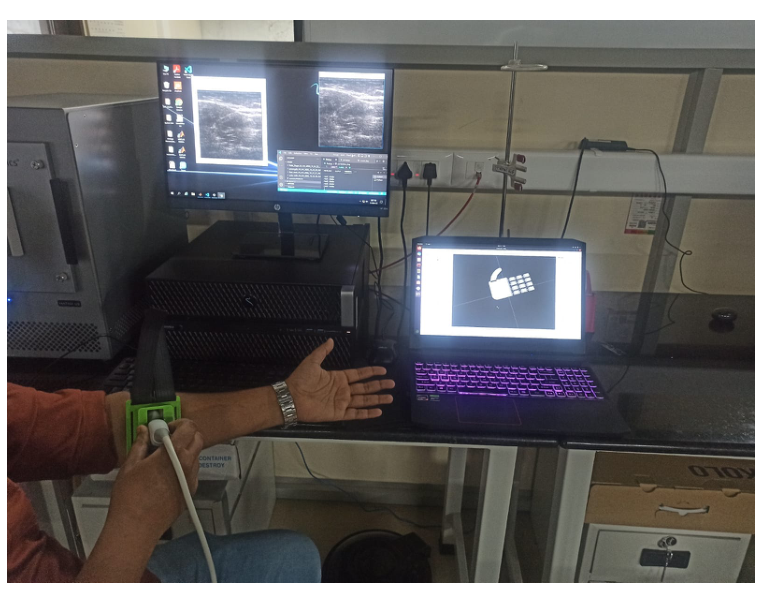 Complete system setup with the probe on the forearm, the Verasonics host displaying live ultrasound, and the laptop running the ROS virtual hand.