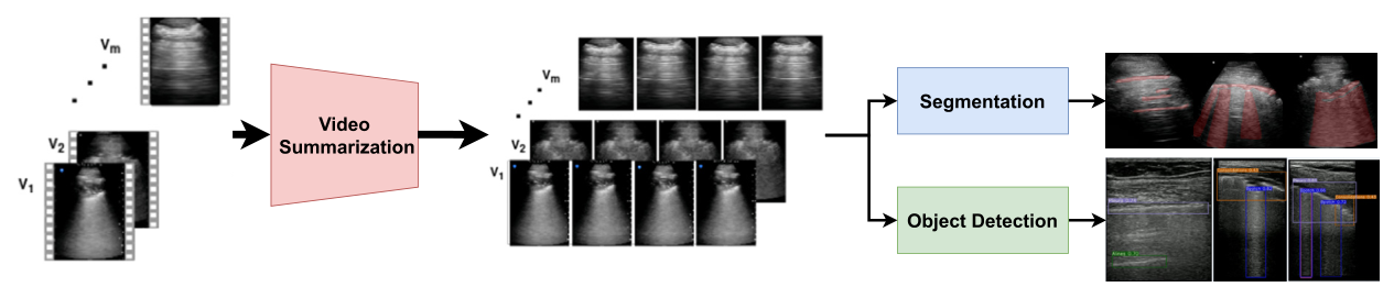 SPAALUV package overview: multiple uploaded ultrasound videos pass through a video summarization block, producing a smaller set of key frames per video, which then branch into a segmentation output highlighting the pleura and abnormalities, and an object detection output showing bounding boxes with confidence scores.